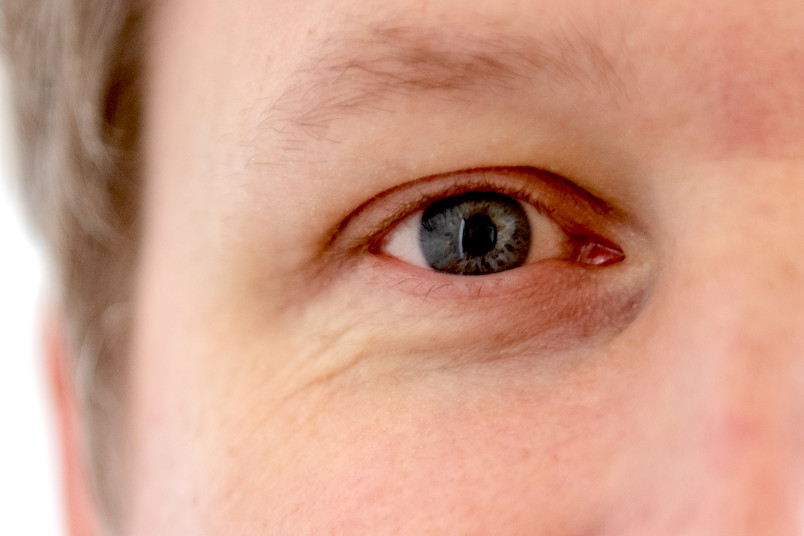 Eye Eye